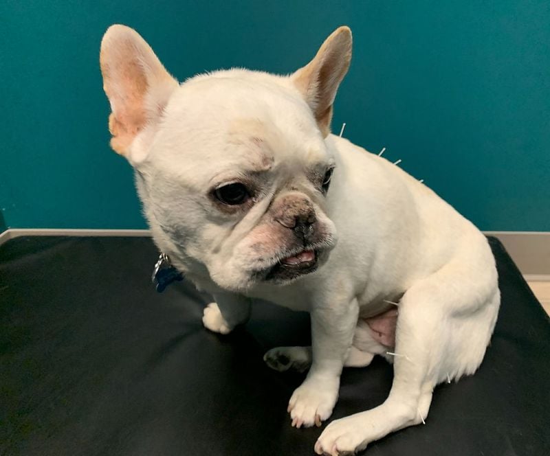 Acupuncture or Laser Therapy